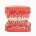 Best ways to care for your dental implants
